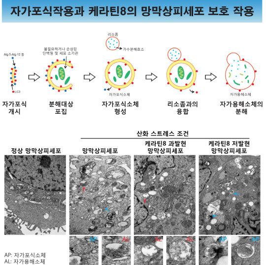 산화 스트레스 조건에서 망막색소상피세포 내 자가포식작용과 케라틴8의 보호역할을 설명하는 이미지. 손상된 단백질과 세포 소기관 및 세포내 찌꺼기 독성 응집체들을 포집해 분해하는 과정인 자가포식작용은 산화 스트레스 조건에서 망막색소상피세포를 세포 사멸로부터 보호한다. 전자 현미경으로 관찰한 결과 산화 스트레스 하에서 케라틴8이 과발현된 세포에서는 자가용해소체가 주를 이루고, 케라틴8이 저발현된 세포에서는 자가포식소체가 주를 이룬다. 이를 통해 케라틴8이 자가용해소체의 형성을 도와 자가포식작용이 원활히 이뤄지도록 함으로써 세포를 보호하게 된다. 건국대 제공